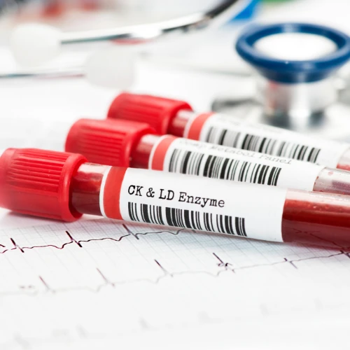 Imagen de: CREATIN QUINASA (CK) 