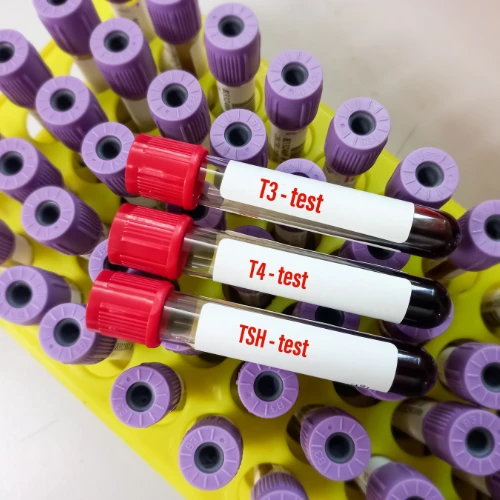 Imagen de: PBI, TSH, T3 TOTAL, T4 TOTAL, T4 LIBRE