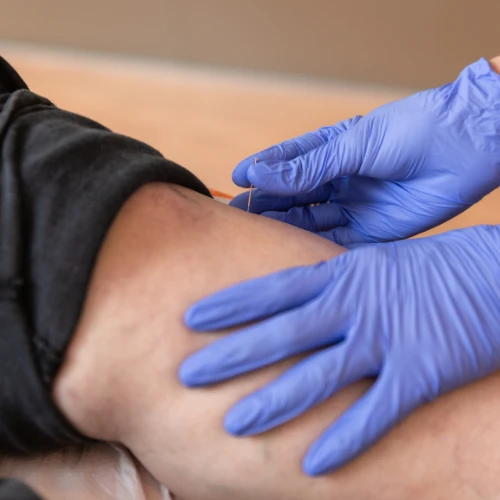 Imagen de: TIEMPO DE SANGRADO