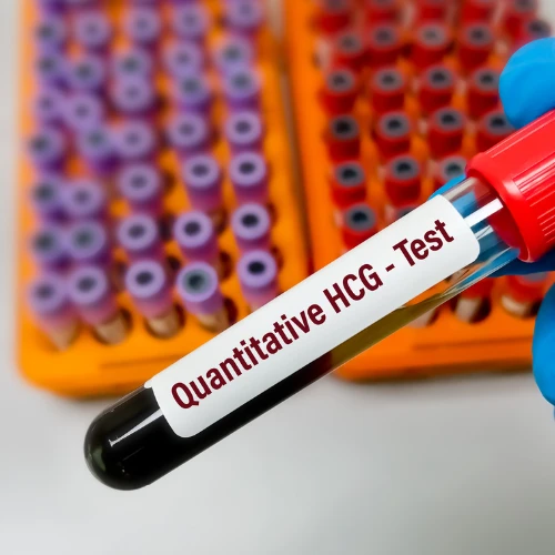 Imagen de: HGC (gonadotropina coriónica humana)