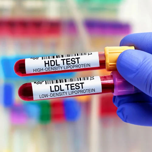 Imagen de: COLESTEROL ALTA Y BAJA DENSIDAD