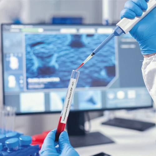 Imagen de: TRANSAMINASA OXALACÉTICA(TGO) 