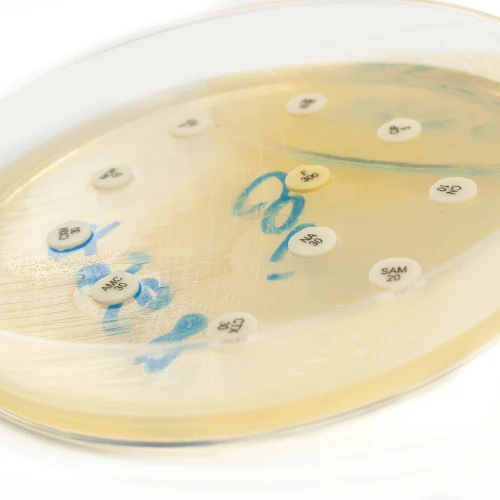 Imagen de: MOCO NASAL, EXUDADO FARINGEO, HECES, ORINA, EXUDADO VAGINAL