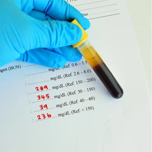 Imagen de: LÍPIDOS TOTALES