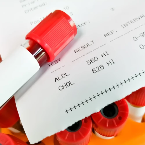 Imagen de: COLESTEROL TOTAL
