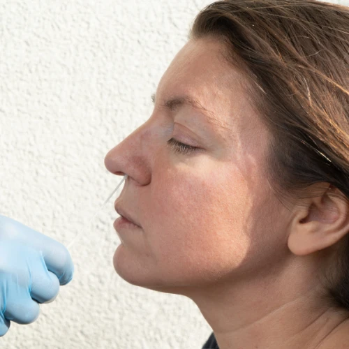 Imagen de: EOSINÓFILOS MOCO NASAL 