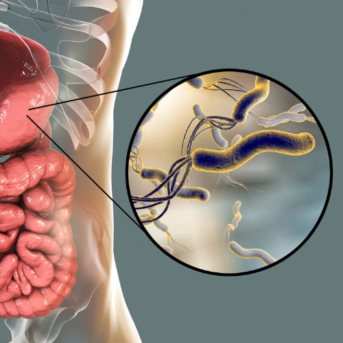 Imagen de: HELICOBACTER PYROLI