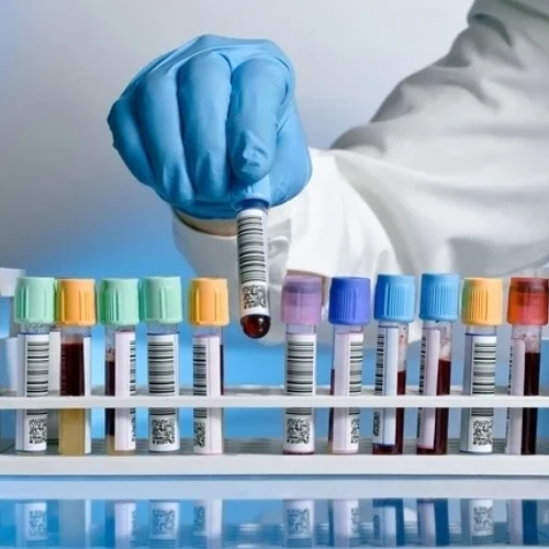 Imagen de: TRANSAMINASA PIRÚVICA (TGP)