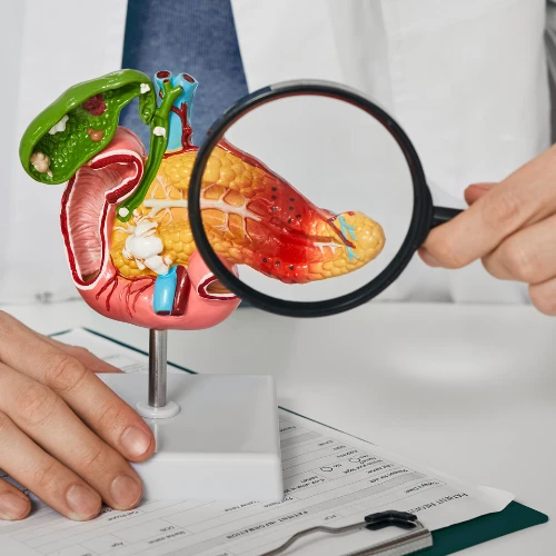 Imagen de: ANTÍGENO CA 19-9 (PÁNCREAS)