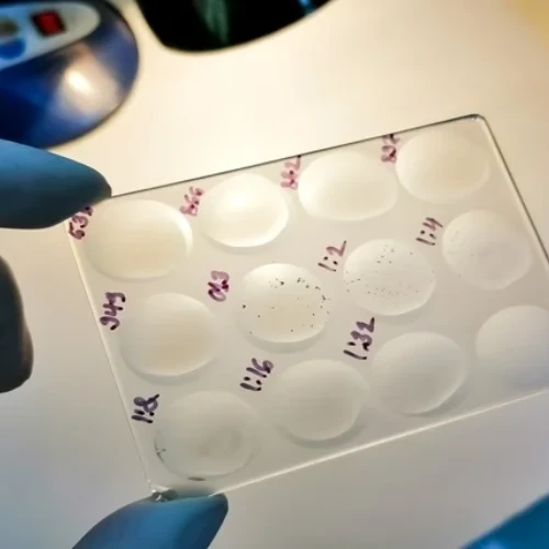 Imagen de: REACCIONES V.D.R.L.