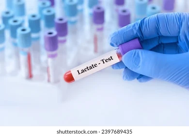 Imagen de: LACTATO DESHIDROGENASA (LDH)