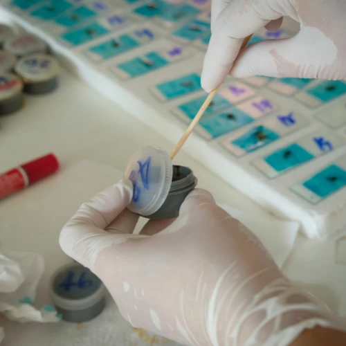 Imagen de: AMIBA EN FRESCO