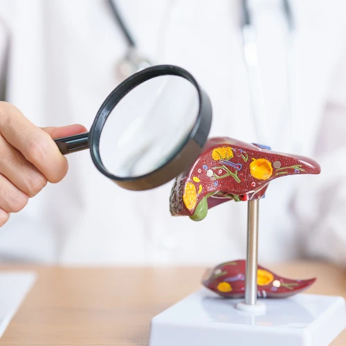 Imagen de: HEPATITIS VIRAL (VIRUS A+B)