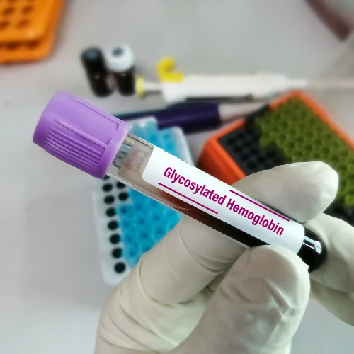 Imagen de: HEMOGLOBINA GLICOSILADA
