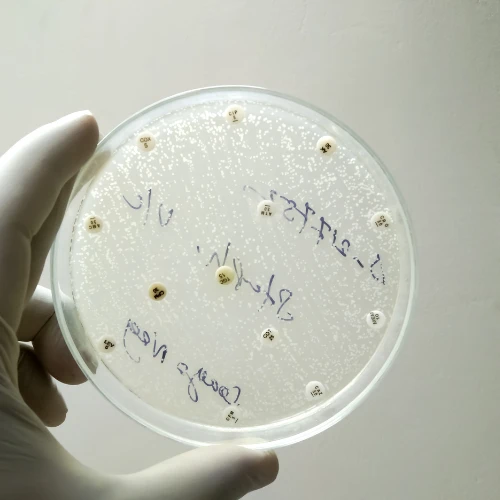 Imagen de: KOH (HONGOS)