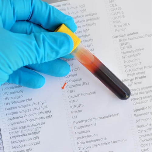 Imagen de: ESTRADIOL